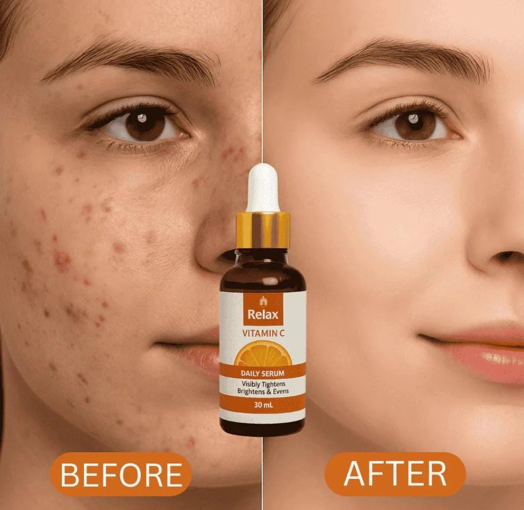 Relax Vitamin C Daily Serum - 30ml